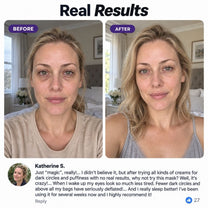 G07 real results